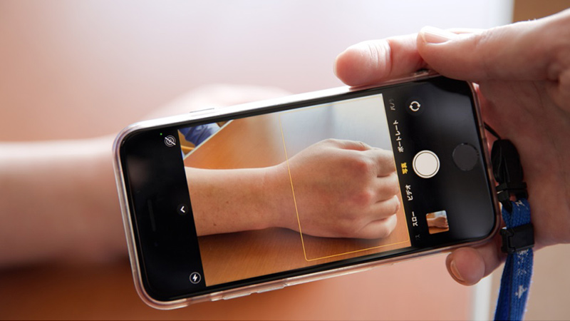 秋田病院　患者さんの状況を撮影する様子