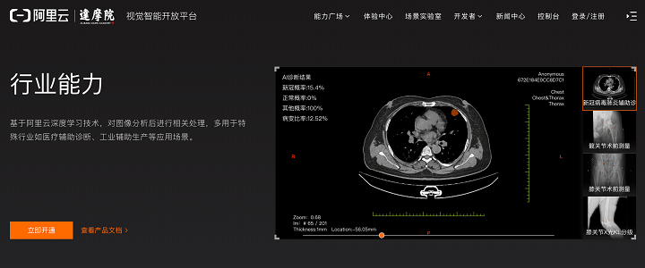 Alibaba Cloud（阿里云）のCT画像解析ソリューション（出典：Alibaba Cloud中国サイト）